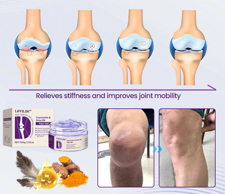 Curcumin & Emu Oil Pain Gel – 🏥Backed by US Osteopathic Experts