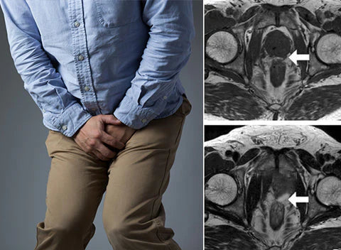 🚀Miniyou™Zirconium Ring