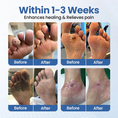 VitaGluco Diabetes Treatment Cream