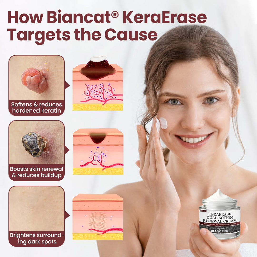 Biancat®KeraErase Dual-Action Renewal Cream