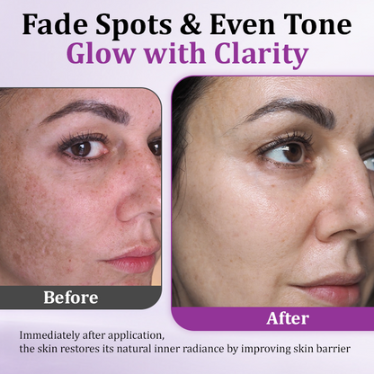 Slimoly™ MelantraX Advanced Anti-Hyperpigmentation Essence