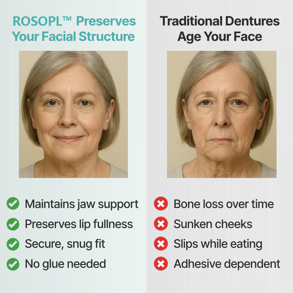 ✨Ends Today: 70% OFF! ROSOPLTM Custom-Fit Full Functional DenturesMake you more confident